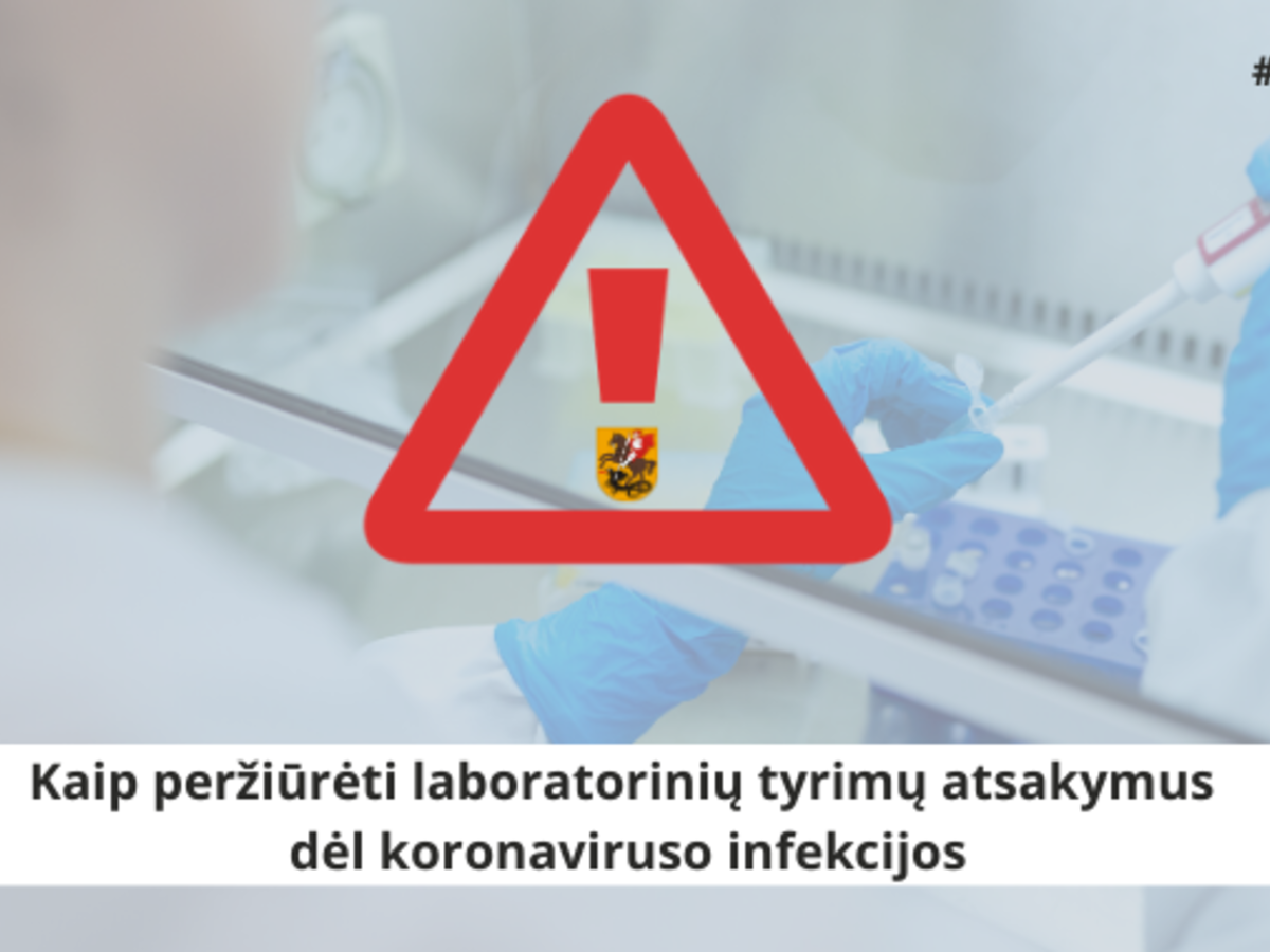 Laboratorinių tyrimų atsakymus dėl koronaviruso infekcijos peržiūrėkite internete